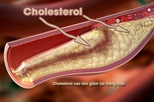 Cholesterol cao