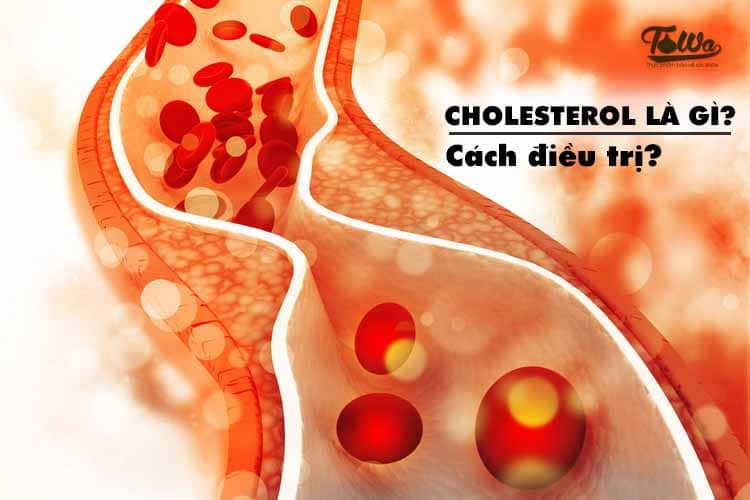 Tỏi đen trị cholesterol